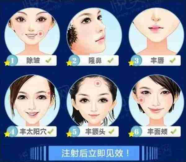 玻尿酸要打就得打一辈子,不打就会变更丑?