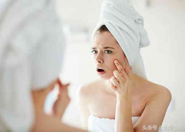 怎么消痘印最快小妙招:3个小妙招快速修复痘印