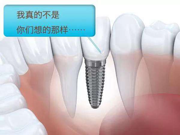 什么叫种植牙(种植牙费用是多少)