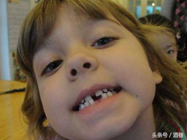 梦到掉牙是什么意思?快来看看吧