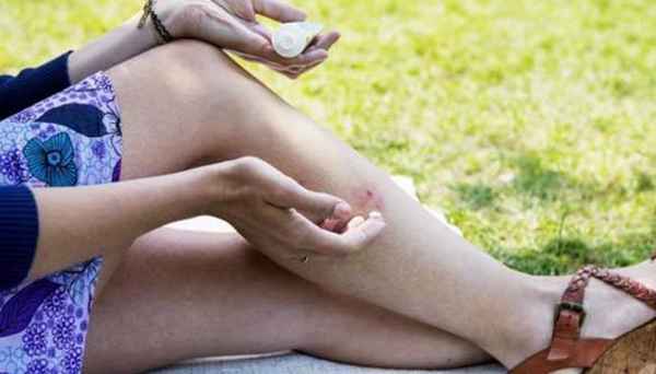 蚊子最喜欢咬哪种血型的人？最靠谱的驱蚊止痒方法都在这了