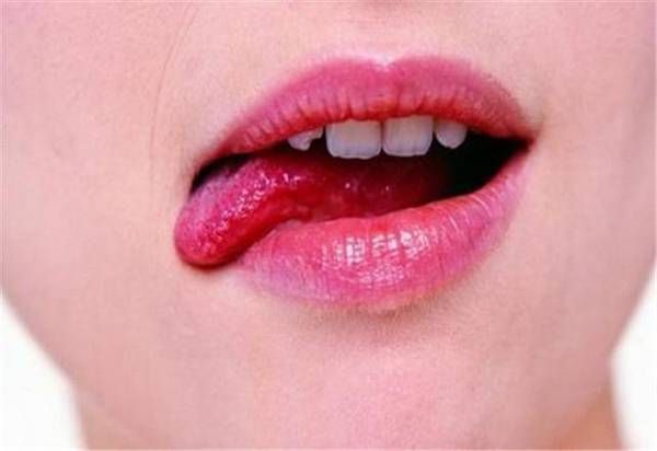 为啥到了秋冬季嘴角总溃烂,真的是上火了吗?听听教授怎么说