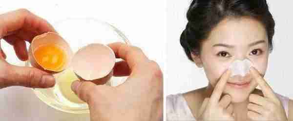 如何正确去黑头,尤其是鼻子?你需要知道的去黑头大全