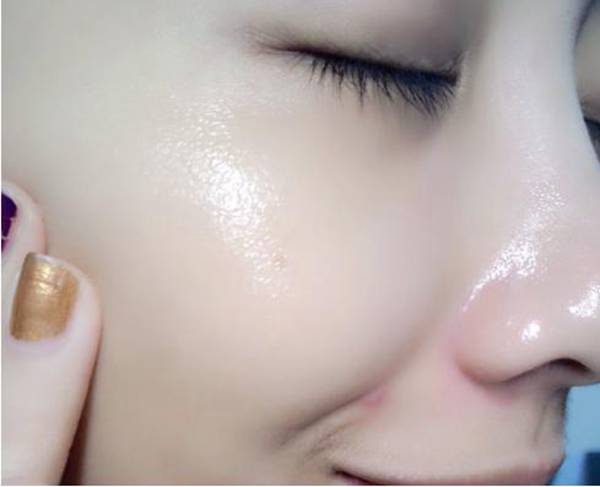 脸上长粉刺是什么原因？该怎么处理？