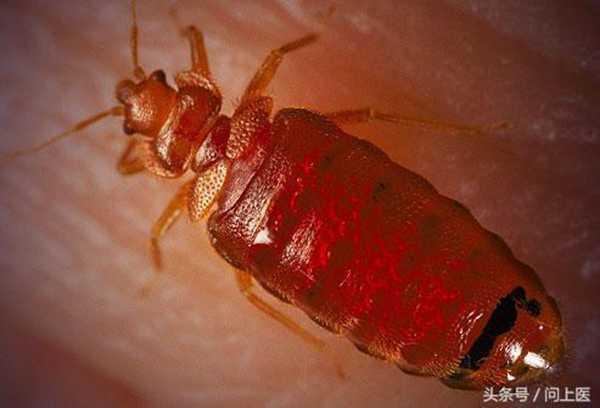 怎么消灭床上的可恶臭虫?