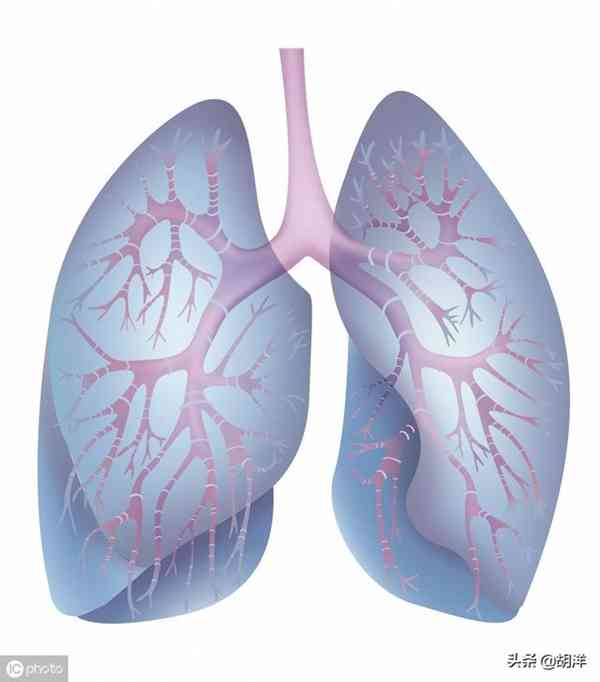 什么样的症状提示肺癌,医生列出7点,每一点都可能是肺癌征兆
