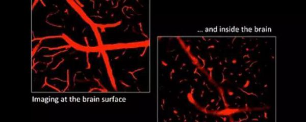 人为什么一定要睡觉？有一个很牛逼的原因