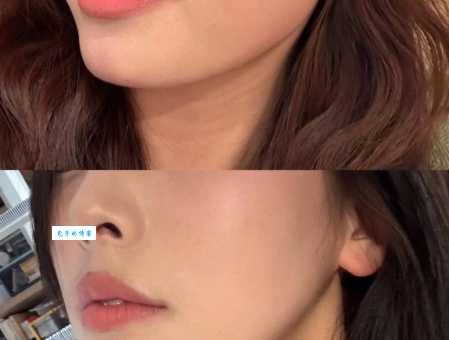 女生瘦脸方法推荐,快速get上镜小V脸!