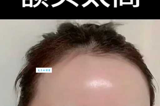 高额头星人必看！快速改善高额头的小妙招