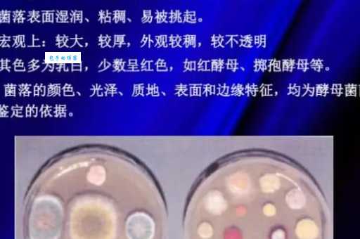 酵母菌是植物还是动物？它到底属于什么类型的生物？