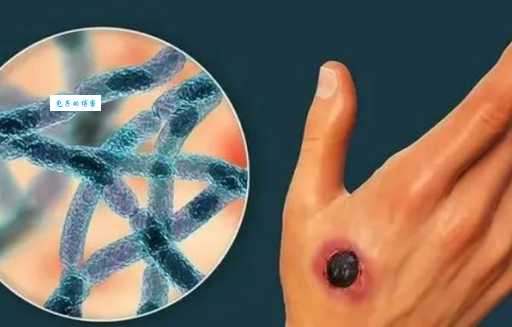 如何读炭疽的拼音？简单易懂的炭疽拼音教学。