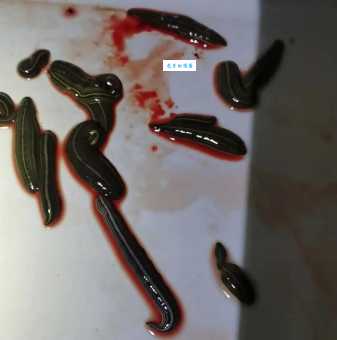 蚂蝗吃什么才能长得快？养殖蚂蝗需要注意哪些饮食问题？